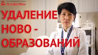 Новообразования (виды, причины, способы удаления) Новообразования (виды, причины, способы удаления)