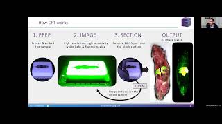 Next-Generation Volumetric Animal and Tissue Imaging by Cryo-Fluorescence Tomography