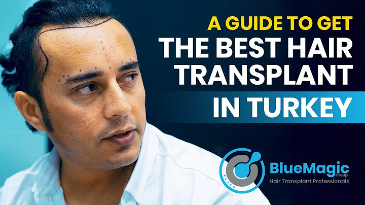 Best hair transplant in turkey reviews năm 2024