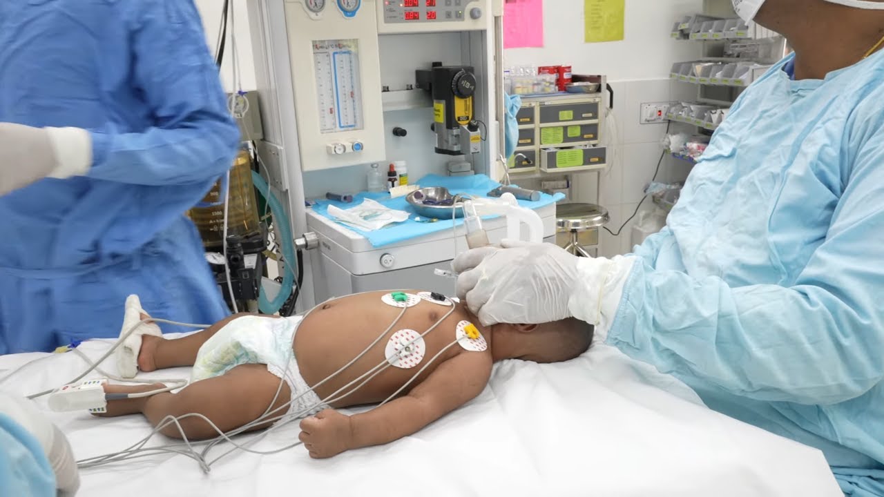 Anesthesia For Little Baby Reconstructive Surgery Little Babies Plastic Surgery Anesthesia For Little Baby Reconstructive Surgery Little Babies Plastic Surgery