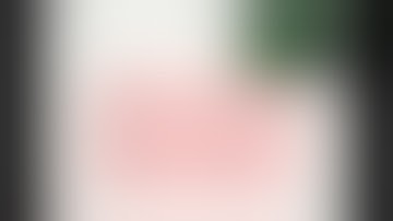 Indocyanine green (ICG) fluorescence robotic cholecystectomy