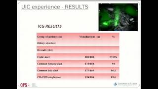 Indocyanine green (ICG) fluorescence robotic cholecystectomy