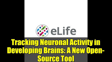 Tracking Neuronal Activity in Developing Brains: A New Open-Source Tool