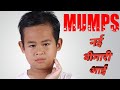 Mumps Virus कितना खतरनाक, जानिए इससे बचने का क्या है कारण ?। What Is Mumps // mumps virus in hindi