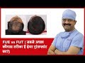 Fue vs fut which one is a best method of hair transplant  hairmd pune  in hindi