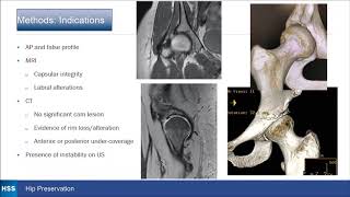 Salvage Pao Outcome For Iatrogenic Hip Instability E. Sink