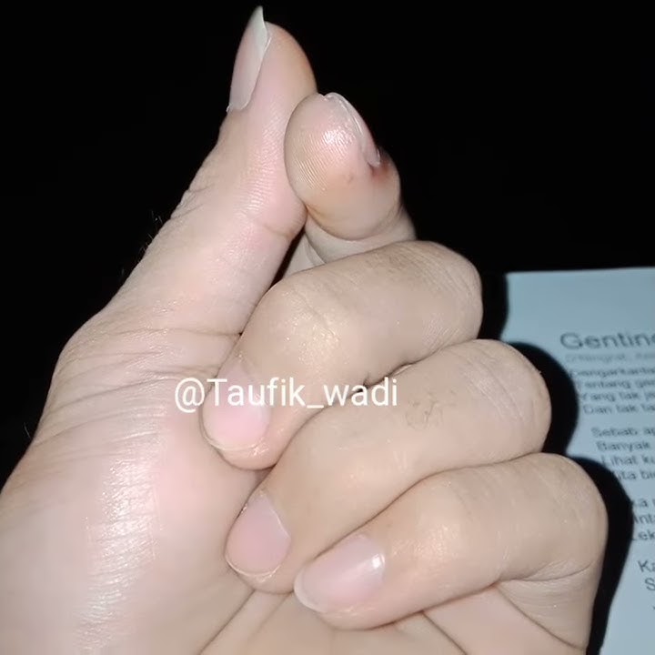 Katakan sayang mengapa begini (Genting) story' wa 30 detik story' tiktok 30 detik [wadi sipit]