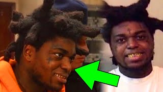 Kodak Black Fans Are Concerned For Him Does Not Look The Same