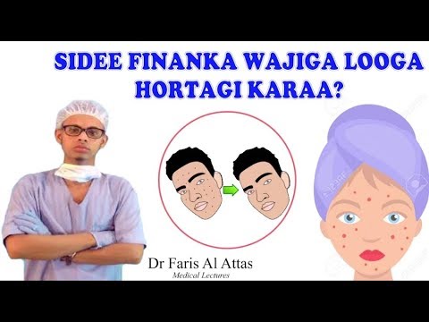 Paypoqda, u sizga uning chanogini yalash imkonini beradi