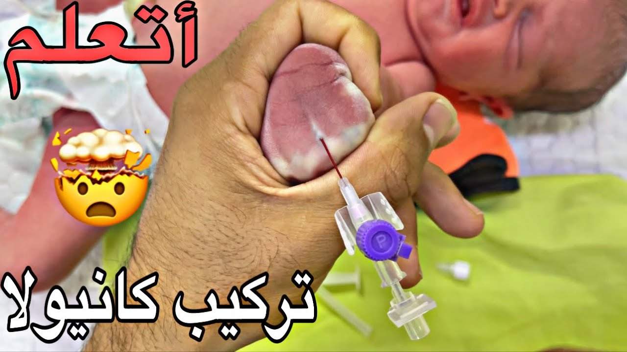 تعلم تركيب الكانيولات للاطفال _ Learn how to inserion cannula for children