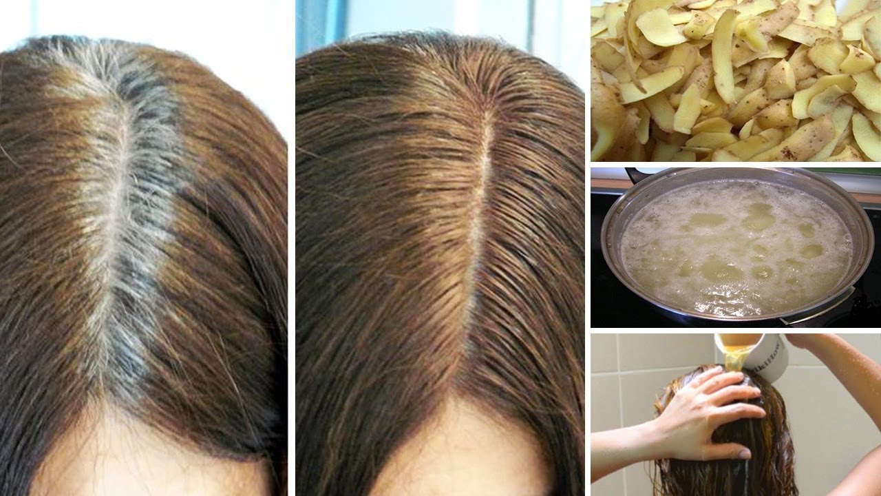 Get Rid of Gray Hair Naturally With Potato Skins YouTube