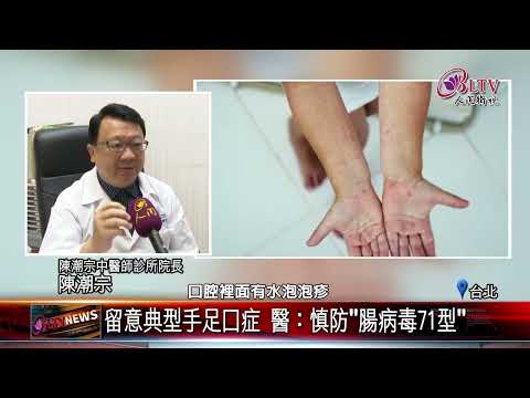 20240506國內腸病毒進流行期！門急診就醫人數破萬人｜@FGSBLTV