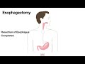 HCC 1475-10a - Surgical Anatomy - Esophagectomy