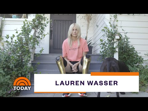 Model Who Lost Legs To Toxic Shock Syndrome Shares Inspiring Mission | Today