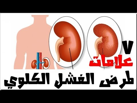 فيديو: هل يجري النفخ بيلي كل يوم؟