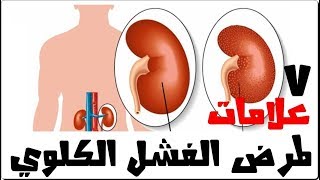 7 علامات إذا رأيتها على جسمك فاعلم أنها تشير بقرب اصابتك بالفشل الكلوى تعرف عليها فوراً