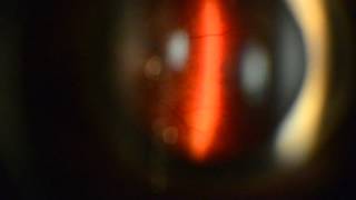 Pat12219 Weiss Kleine Inf Ant Floater Duet Lee