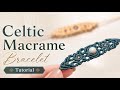 DIY Micro Macrame Bracelet✨
