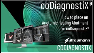 How to place an Anatomic Healing Abutment in coDiagnostiX