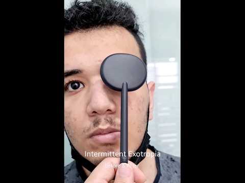 تعديل حول وحشي متناوب