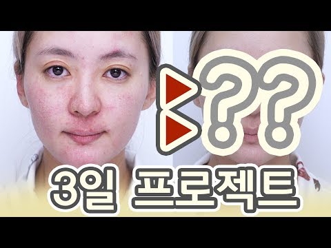 여자스킨로션 추천