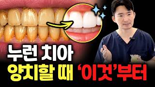 치아 미백 돈 쓰지 마세요. 누런 치아라면 꼭 확인할 5가지