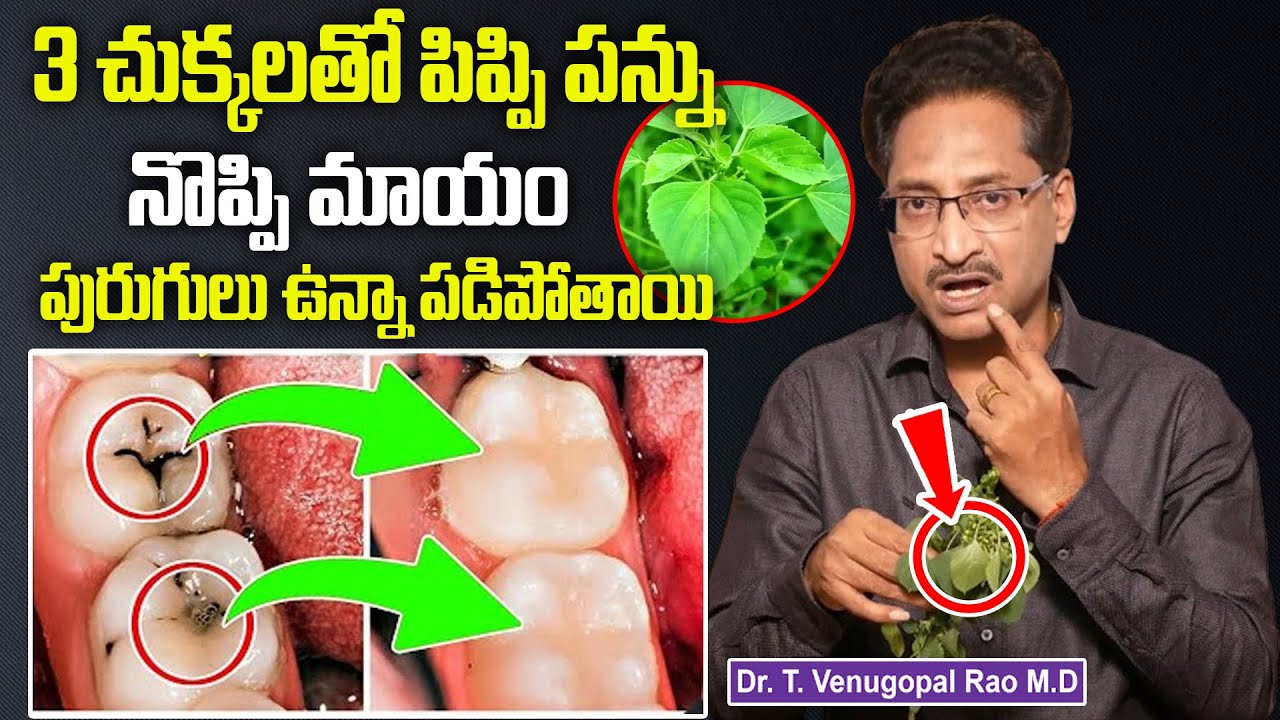 Dr.Venugopal - 3 చుక్కలతో పిప్పి పన్ను నొప్పి మాయం | Pippi Pannu Remedy || Dental Cavities