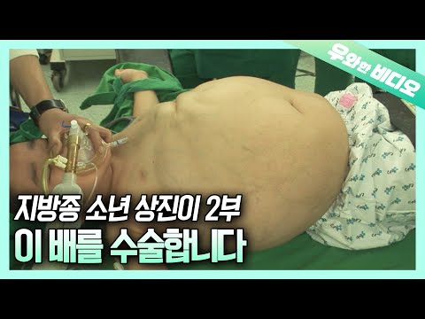 (2부) 부푼 배를 안고 산 9살 상진이, 과연 수술 결과는?