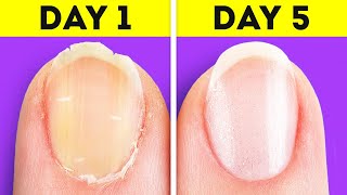 Genius hacks to save the beauty of your nails || Cool nail designs