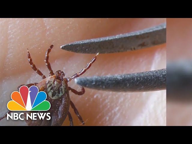 New research may reveal why Lyme disease causes chronic symptoms for some class=