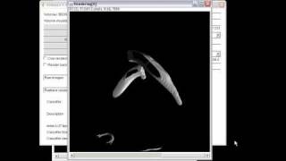 Volume Extraction InsilicoSurgeon ImageJ