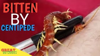 centipede bite giant