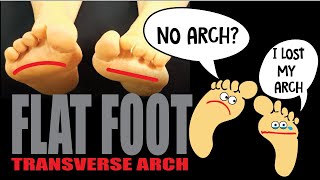 Flat Foot You Can Fix It!  Easy 3 Exercises at Home #massagetherapy