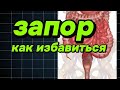 Хронические запоры? Кишечник можно восстановить за 7 дней без таблеток