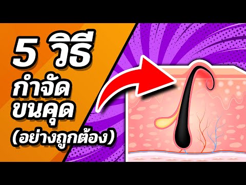 📌😍 5 วิธีกำจัดขนคุด (อย่างถูกต้อง) ง่ายและทำตามได้ทันที