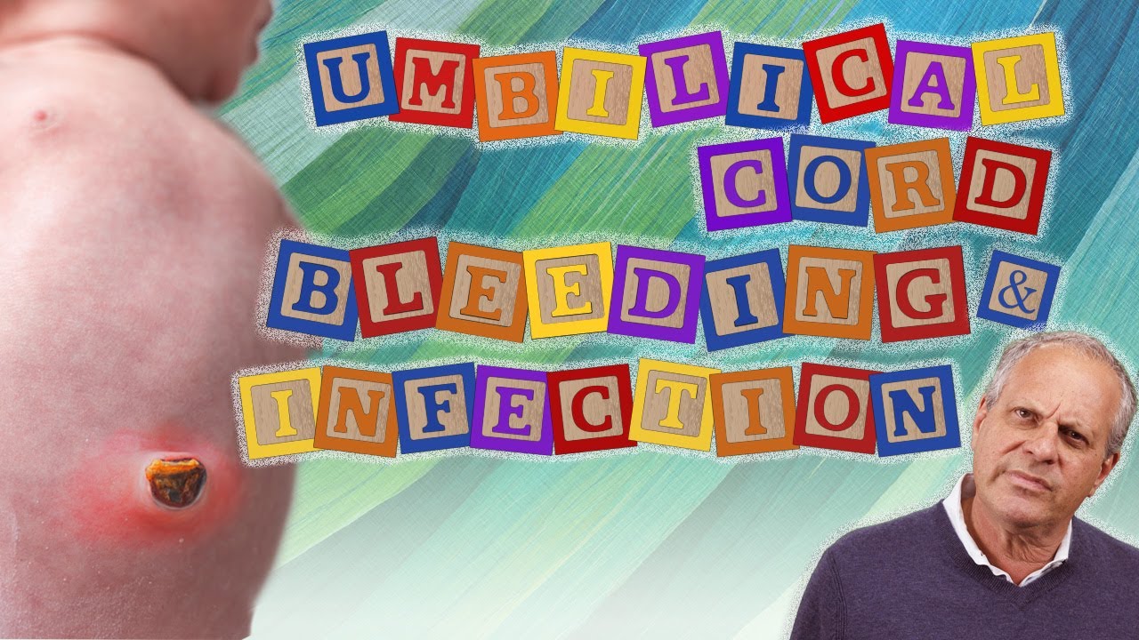 Newborn Issues of Umbilical Cord Bleeding & Infection YouTube
