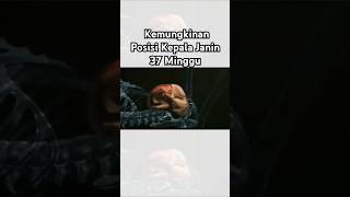 Kemungkinan Posisi Kepala Janin 37 Minggu