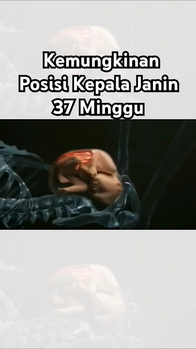 Kemungkinan Posisi Kepala Janin 37 Minggu