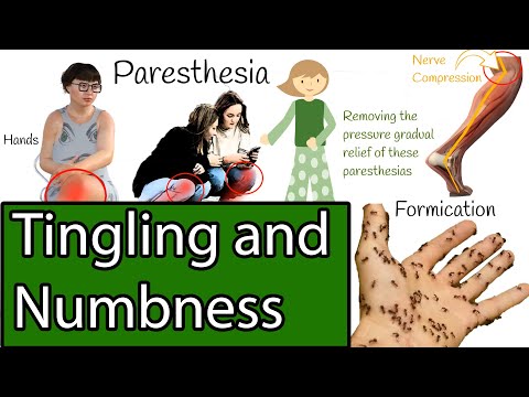 Numbness and Tingling,  Causes of Paresthesia