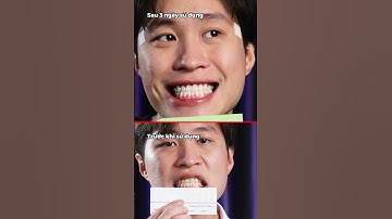 Chữa vàng răng trong 7 ngày? Kiểm chứng kit làm trắng răng Smilee Extra White | Long Khoa Học