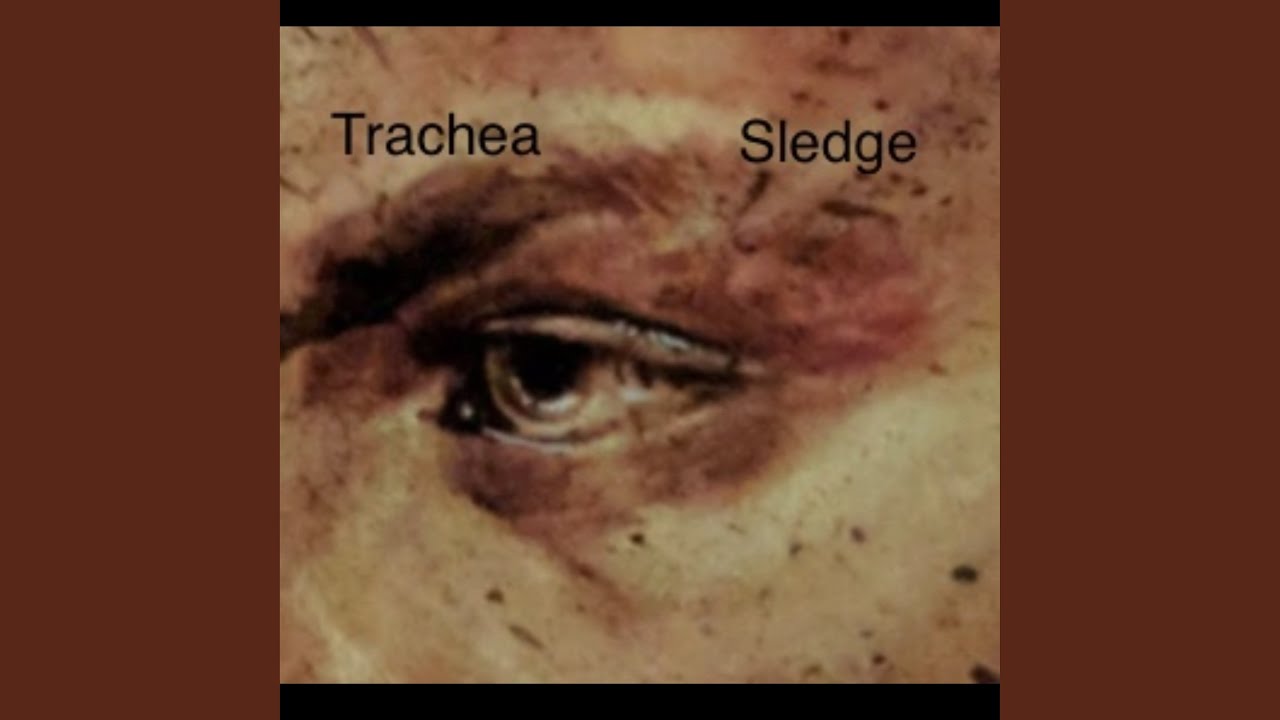 Watch Sledge on YouTube Watch Sledge on YouTube