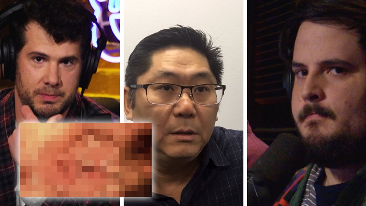 Steven's Doctor Examines 1/4 Black Garrett's Mysterious Condition