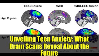 Unveiling Teen Anxiety: What Brain Scans Reveal About the Future