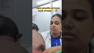 hairy growths on lower back of newborn baby🩺👩‍⚕️#shorts#doctor#viral#trending#newborn#new#news#nicu