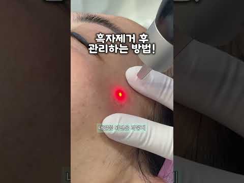 흑자제거 후 관리하는 방법 — 리연케이의원 원장 영상