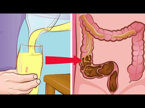 How to clean the intestines from 15 kg of waste. Get rid of years of mucus, feces and parasites!