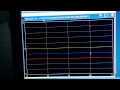 A6 V6 VCDS TDI graph - timing issues