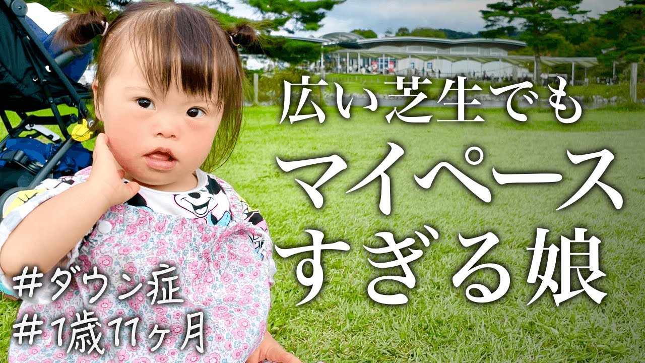 簡単ご紹介 ダウン症12の特徴 Youtube 簡単ご紹介 ダウン症12の特徴 Youtube