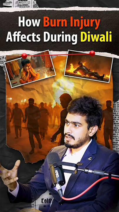 Burn Injuries During Diwali: Real Incidents, Safety Tips & First Aid Guide #burntreatment