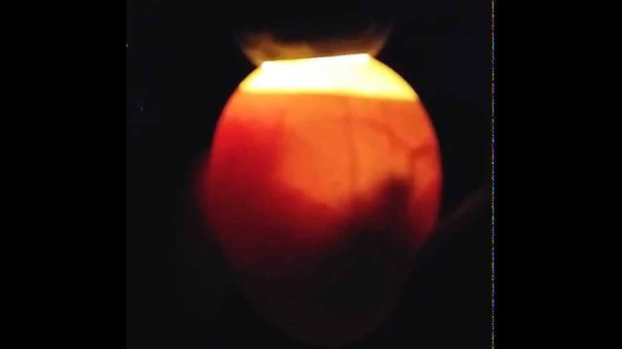 Embryon D Oeuf De Poules A 11 Jours Youtube